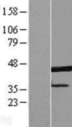 Novus Biologicals&trade;&nbsp;ERLIN1 Overexpression Lysate