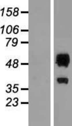 Novus Biologicals&trade;&nbsp;ERMAP Overexpression Lysate