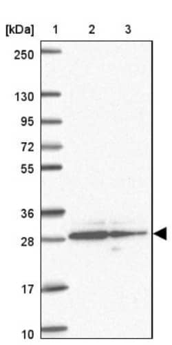 ER Membrane Protein Complex Subunit 10 Antibody, Novus Biologicals 0.1mL;