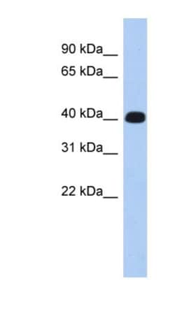 ERMN Antibody, Novus Biologicals 100&mu;L; Unlabeled:Antibodies, Polyclonal