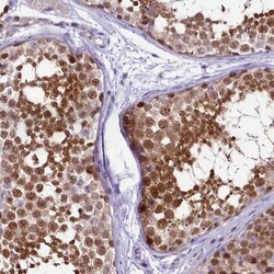 ERMN Antibody, Novus Biologicals:Antibodies:Primary Antibodies