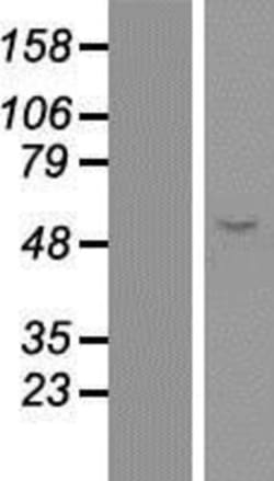 Novus Biologicals&trade;&nbsp;ERO1L Overexpression Lysate