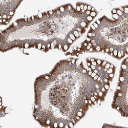 ERO1L Antibody, Novus Biologicals 25ul | Buy Online | Novus Biologicals | Fisher Scientific