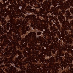 ERP27 Antibody, Novus Biologicals 0.1mL; Unlabeled:Antibodies, Polyclonal