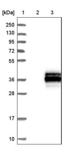 ERP27 Antibody, Novus Biologicals 0.1mL; Unlabeled:Antibodies, Polyclonal