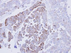 ERP29 Antibody, Novus Biologicals 0.1mg; Unlabeled:Antibodies, Polyclonal