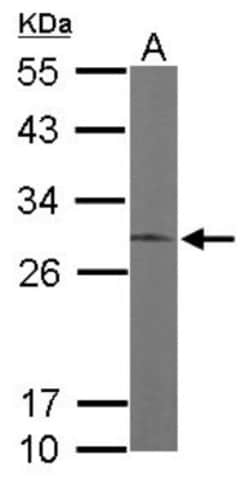 ERP29 Antibody, Novus Biologicals 0.1mg; Unlabeled:Antibodies, Polyclonal