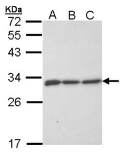 ERP29 Antibody, Novus Biologicals 0.1mg; Unlabeled:Antibodies, Polyclonal