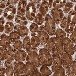ERP44 Antibody, Novus Biologicals 25 &mu;L | Buy Online | Novus Biologicals | Fisher Scientific