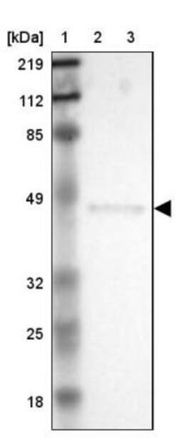ERP44 Antibody, Novus Biologicals 25 &mu;L | Buy Online | Novus Biologicals | Fisher Scientific