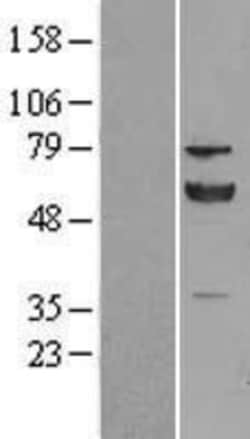 Novus Biologicals&trade;&nbsp;ERp57/PDIA3 Overexpression Lysate