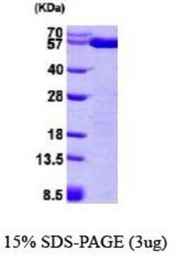 Novus Biologicals Recombinant Human ERp57/PDIA3 His Protein 0,1 mg | Buy Online | Novus Biologicals&trade; | Fisher Scientific