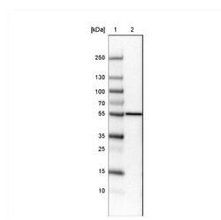 ERp57/PDIA3 Antibody (CL2446), Novus Biologicals 0.1mL; Unlabeled:Antibodies,