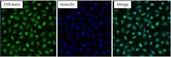 ERR beta/NR3B2 Antibody, Novus Biologicals 0.1mg; Unlabeled:Antibodies,
