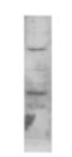 ERR beta/NR3B2 Antibody, Novus Biologicals 0.1mg; Unlabeled:Antibodies,