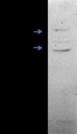 ERR beta/NR3B2 Antibody, Novus Biologicals 0.1mg; Unlabeled:Antibodies,