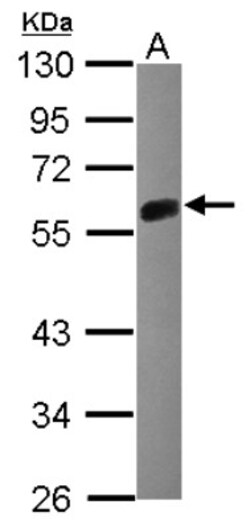 ERRFI1 Antibody, Novus Biologicals 0.1mL; Unlabeled:Antibodies, Polyclonal