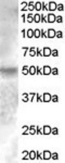 ERR gamma/NR3B3 Antibody, Novus Biologicals 0.1mg; Unlabeled:Antibodies,