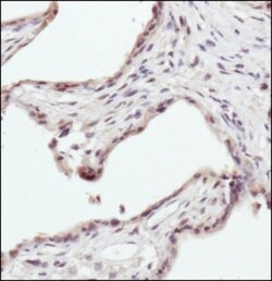 Erythropoietin R Antibody - BSA Free, Novus Biologicals 0.1mL; Unlabeled:Antibodies,