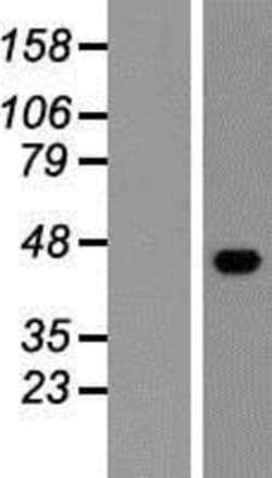 Novus Biologicals™ ESAM Overexpression Lysate