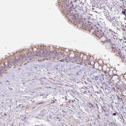 ESAM Antibody, Novus Biologicals 25 &mu;L, Unlabeled:Antibodies, Polyclonal