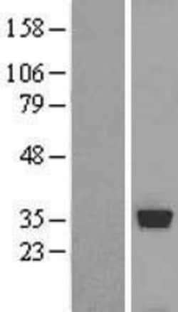 Novus Biologicals&trade;&nbsp;ESD Overexpression Lysate