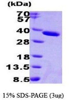 Novus Biologicals&trade;&nbsp;Recombinant Human ESD His Protein