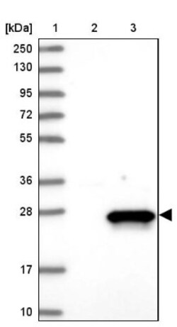 ESD Antibody, Novus Biologicals 0.1mL; Unlabeled:Antibodies, Polyclonal