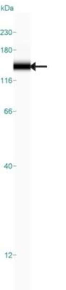 espin Antibody, Novus Biologicals 25 &mu;L | Buy Online | Novus Biologicals | Fisher Scientific