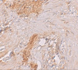 ESRP1 Antibody - BSA Free, Novus Biologicals 0.1mg; Unlabeled:Antibodies,