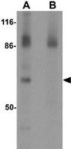 ESRP1 Antibody - BSA Free, Novus Biologicals 0.1mg; Unlabeled:Antibodies,