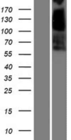 Novus Biologicals™ Carboxylesterase 3/CES3/Esterase 31 Overexpression Lysate
