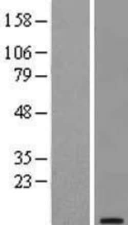 Novus Biologicals&trade;&nbsp;TFF1/pS2 Overexpression Lysate