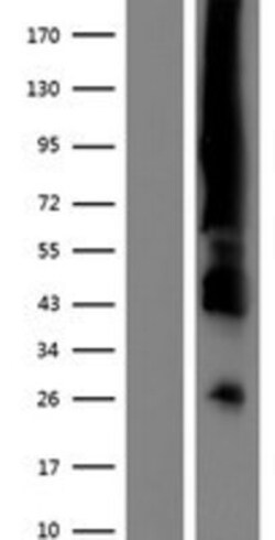 Novus Biologicals&trade;&nbsp;ER alpha/NR3A1 Overexpression Lysate