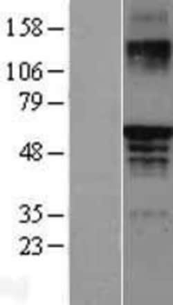 Novus Biologicals&trade;&nbsp;ER beta/NR3A2 Overexpression Lysate