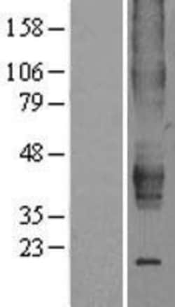 Novus Biologicals&trade;&nbsp;ERR beta/NR3B2 Overexpression Lysate