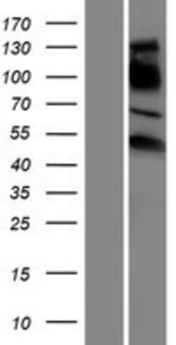 Novus Biologicals&trade;&nbsp;ERR gamma/NR3B3 Overexpression Lysate