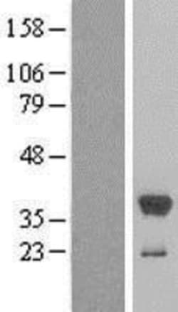 Novus Biologicals&trade;&nbsp;Cytosolic Sulfotransferase 1E1/SULT1E1 Overexpression Lysate
