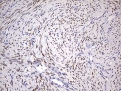 ER alpha/NR3A1 Antibody (OTI2D3), Novus Biologicals 0.1 mL | Buy Online | R&D Systems | Fisher Scientific