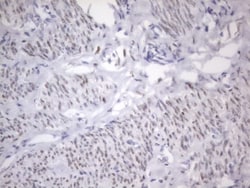 ER alpha/NR3A1 Antibody (OTI2D3), Novus Biologicals 0.1 mL | Buy Online | R&D Systems | Fisher Scientific