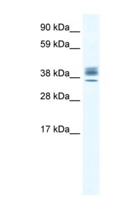 ESX1 Antibody, Novus Biologicals 20&mu;L; Unlabeled:Antibodies, Polyclonal
