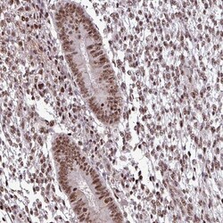 ESX1 Antibody, Novus Biologicals 25 &mu;L, Unlabeled:Antibodies, Polyclonal