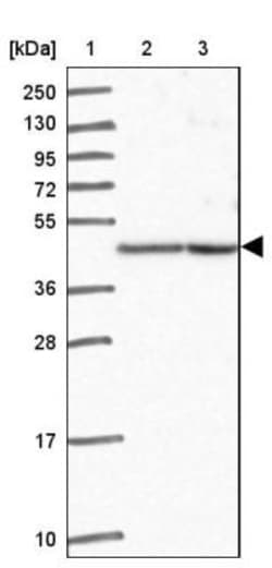 ESX1 Antibody, Novus Biologicals 25 &mu;L, Unlabeled:Antibodies, Polyclonal