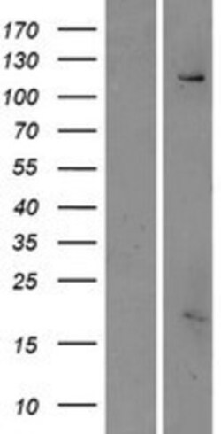 Novus Biologicals&trade;&nbsp;ESYT3 Overexpression Lysate