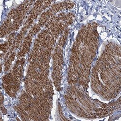 ESYT3 Antibody, Novus Biologicals:Antibodies:Primary Antibodies