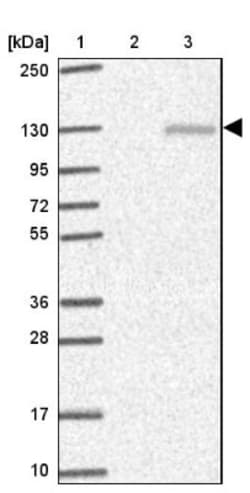 ETAA1 Antibody, Novus Biologicals:Antibodies:Primary Antibodies