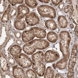 ETAA1 Antibody, Novus Biologicals 0.1mL; Unlabeled:Antibodies, Polyclonal
