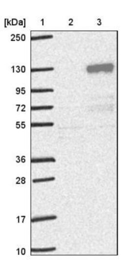 ETAA1 Antibody, Novus Biologicals 0.1mL; Unlabeled:Antibodies, Polyclonal