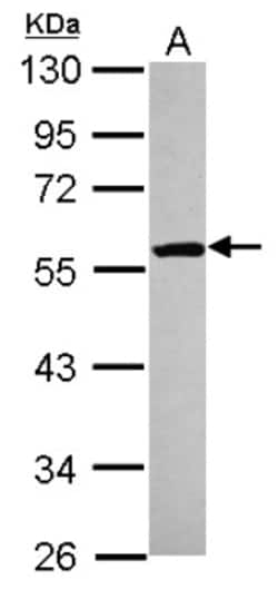 ETEA Antibody, Novus Biologicals 0.1mL; Unlabeled:Antikörper