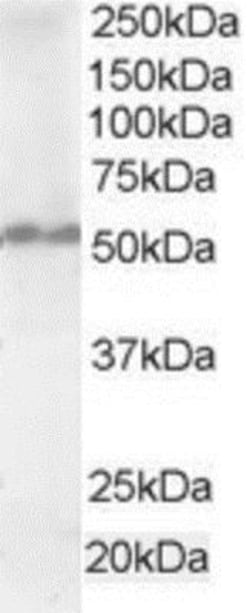 ETEA Antibody, Novus Biologicals 0.1mg; Unlabeled:Antibodies, Polyclonal